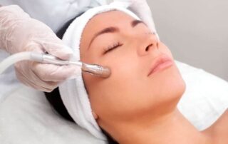 Oxibrasión tratamientos-faciales-medicina-estetica